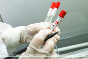 Резидент СЭЗ "Витебск" освоил выпуск тест-системы для одновременного выявления 9 инфекций на фоне COVID
