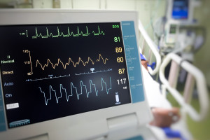 В учреждения здравоохранения Витебской области поступило 100 кардиомониторов